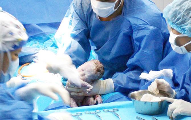 C-Section